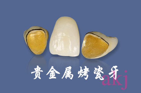 非贵金属烤瓷(非贵金属烤瓷牙和全瓷牙的区别)